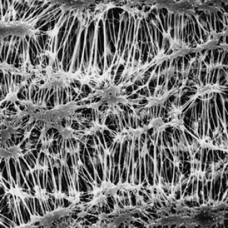 Millipore FHUP04700 Fluoropore 表面滤膜
